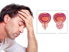 Prostatitis en un hombre
